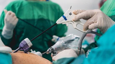 Laparoscopic & Laser Surgery